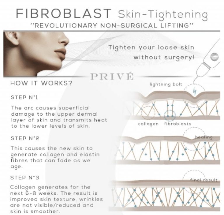 Fibroblast Skin Tightening | Aesthetic Medical Studio | Long Island